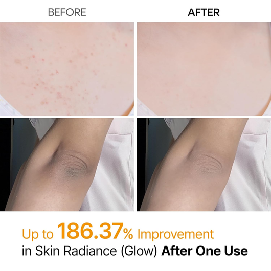 Norré Body Peel+